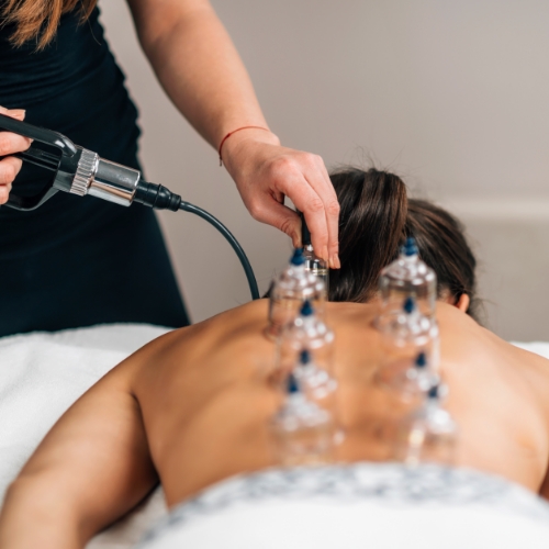 cupping-MeadowLife-Physiotherapy-and-Active-Rehab-Centre-Pitt-Meadows-BC-500x500
